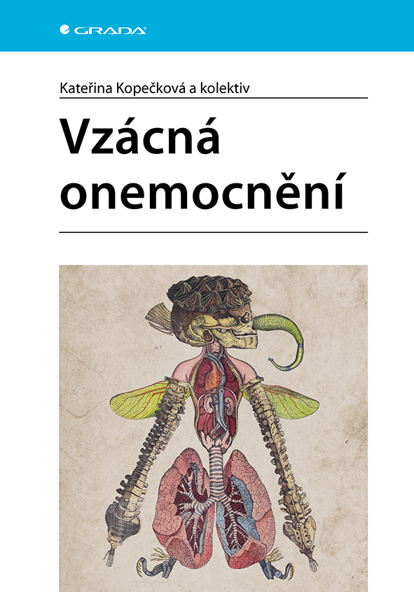 VZÁCNÁ ONEMOCNĚNÍ