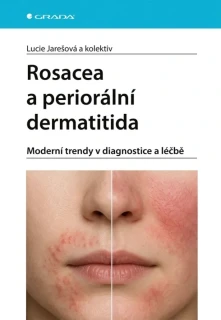 ROSACEA A PERIORÁLNÍ DERMATITIDA